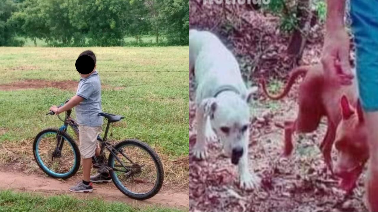 Nino-habria-perdido-su-ojo-tras-ataque-de-perros-en-Pochutla-Oaxaca